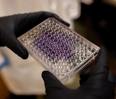 Gloved hands holding a clear container of protein samples.